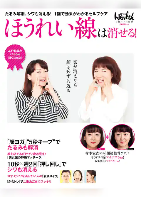 ほうれい線は消せる！