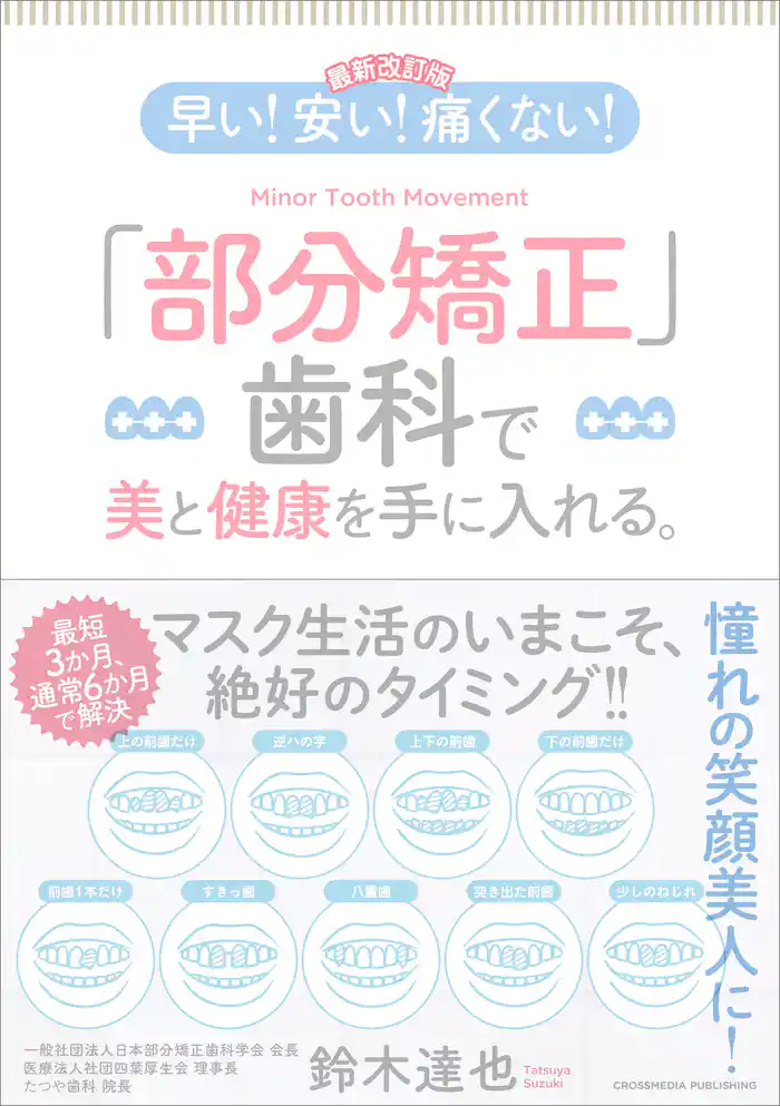 【最新改訂版】早い！ 安い！ 痛くない！ 「部分矯正」歯科で美と健康を手に入れる