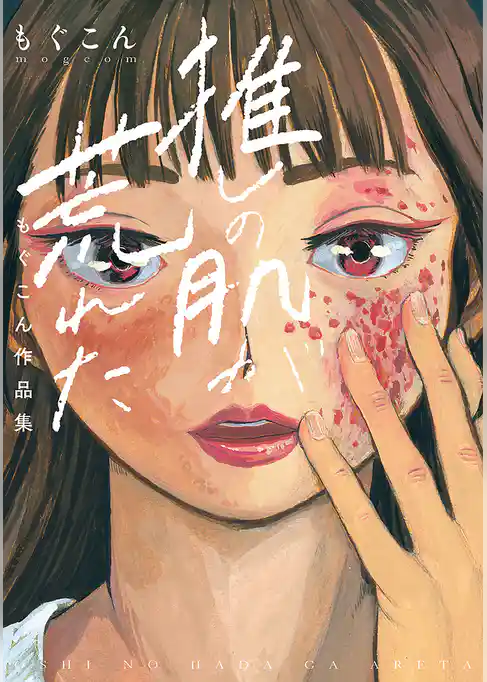 推しの肌が荒れた　～もぐこん作品集～