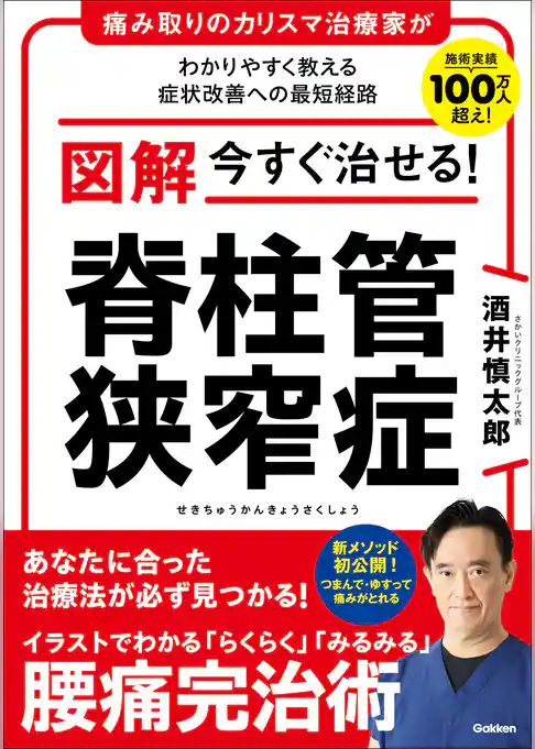 図解 今すぐ治せる！ 脊柱管狭窄症