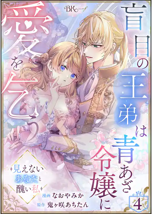 盲目の王弟は青あざ令嬢に愛を乞う ～見えないあなたと醜い私～ コミック版（分冊版）