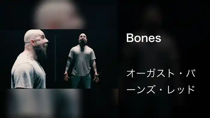 Bones