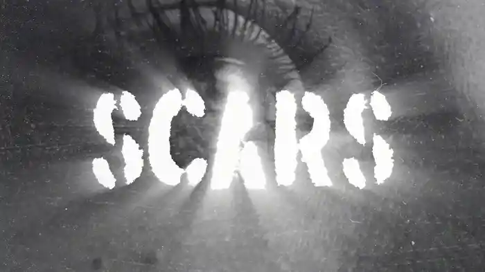 Scars (Lyric Video)