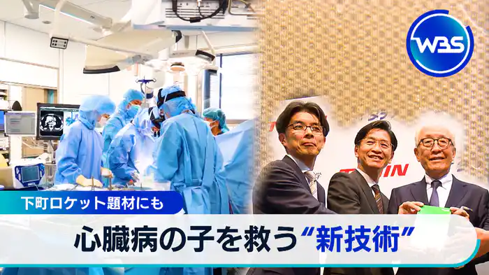 下町ロケット題材にも　心臓病の子を救う“新技術”【WBSクロス】（2024.09.03）