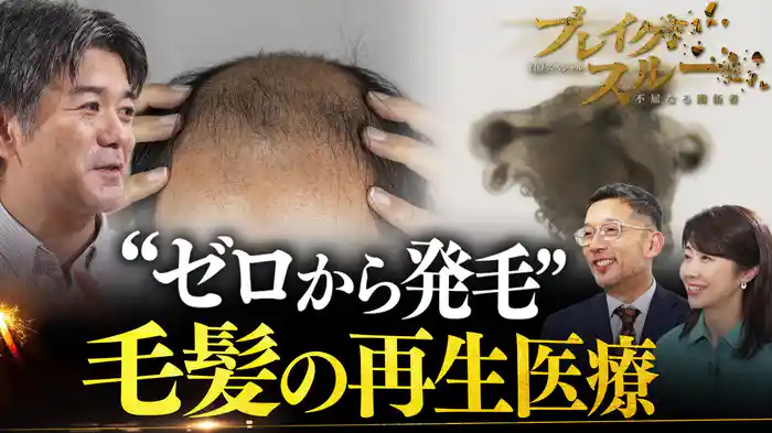 世界初の薄毛治療“毛髪再生医療”
