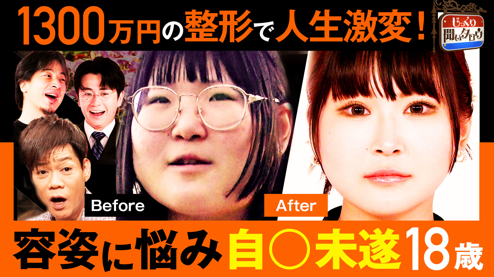 1300万円の顔面フル整形で衝撃アフター大公開！容姿に悩み学校で自殺未遂の18歳…