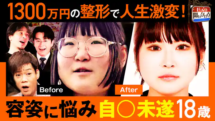 1300万円の顔面フル整形で衝撃アフター大公開！容姿に悩み学校で自殺未遂の18歳…