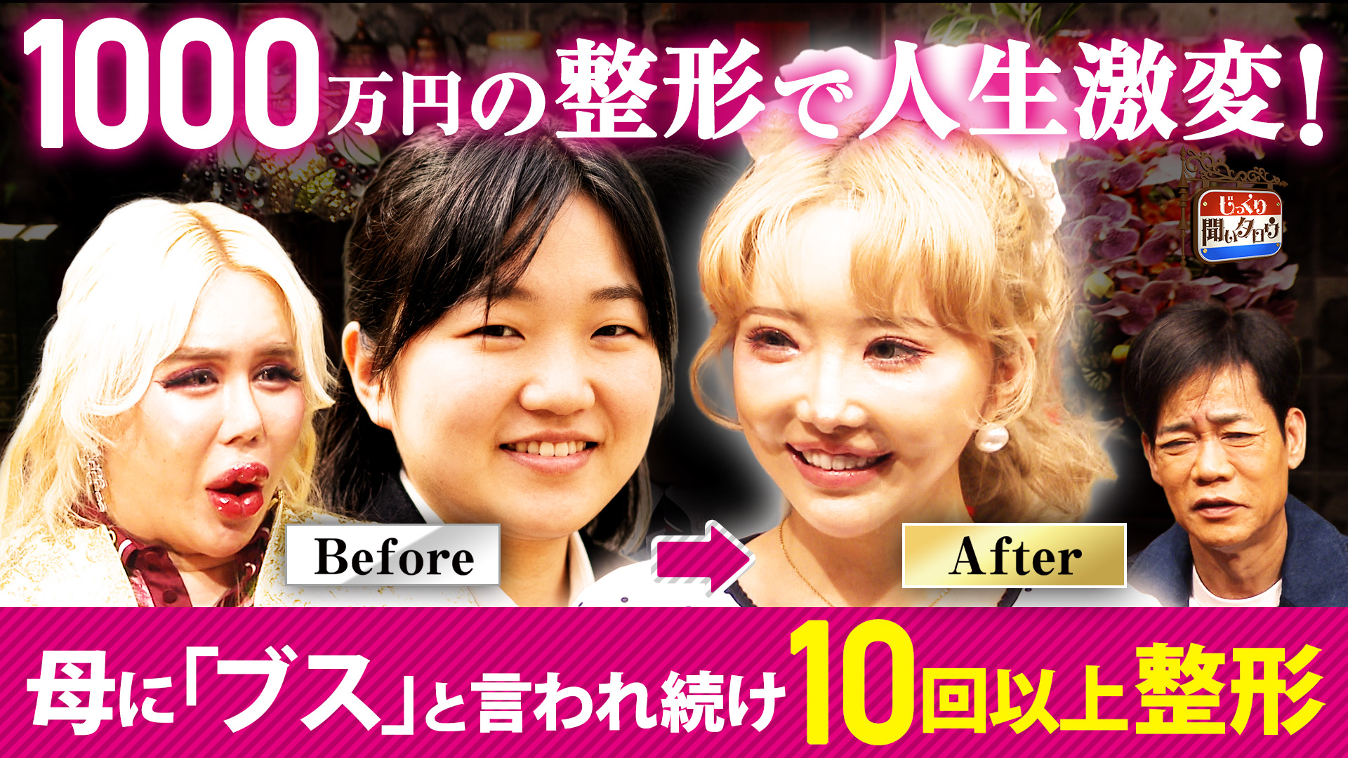 【アレン様参戦】地獄のコンプレックスから大逆転！整形で人生アップデートSP