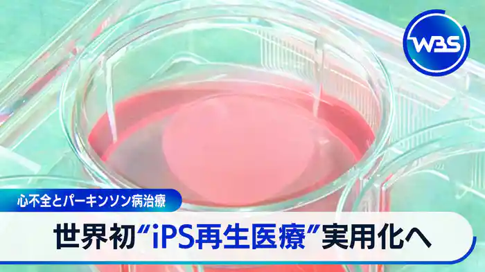 第3の賃上げとは？▽速報!「iPS再生医療」の実用化へ“承認”を了承